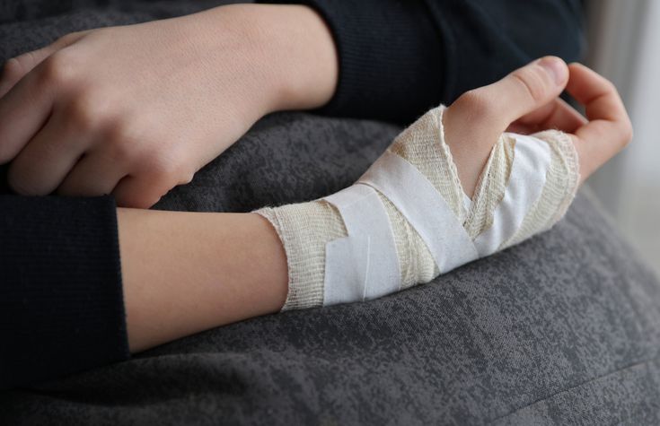 Causes For Wrist Pain and How To Fix It